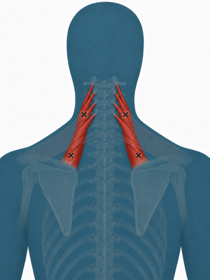 Levator scapulae shown at the side of the neck